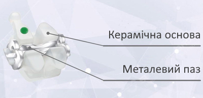 Комбіновані брекет-системи